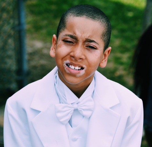 themightydexter:  “I HATE MY LIPS”  After I took this boy’s picture, I was told by his mom how self conscious he is about his vitiligo that’s developed over the past year. She told me that he hates his lips. He avoids looking at himself in the