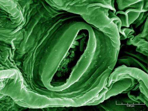 E. coli happens!Here we have an electron microscope image of a head of lettuce. But that&rsquo;s not