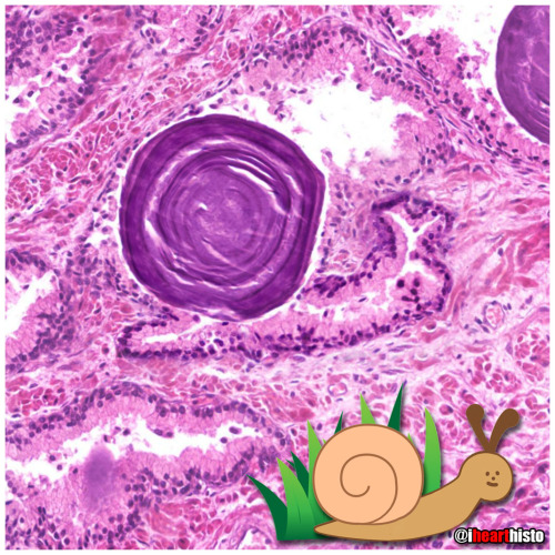  Prostate Snail A secretory gastropod with a corpus amylaceum shell!i❤️histoThis image is a close up