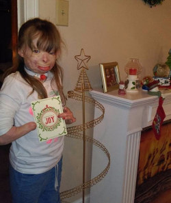 thelastsworld:  zeiyth:  anti-capitalistlesbianwitch:    This Girl Whose Entire Family Got Killed In An Act Of Arson Just Wants Cards For Christmas   Safyre’s Christmas card holder (pictured above) holds 100 cards. Let’s help her fill it up! Christmas