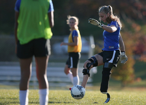 oats-n-whoas:  runningtheremedy:  blondebarbells:  lawgirlrunning:  unusual-passions:  Badly injured at a fundraising car wash. Lost leg but returned to soccer and is now playing at the college level.  BAD. ASS. Tears in my eyes a little. Good reminder