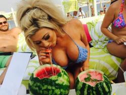 amateur-implant-pics:  nice melons  DalzellSophie