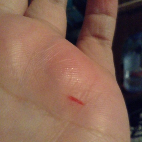 Ng dahil sa avocado at bagong hasa ang knife ko..