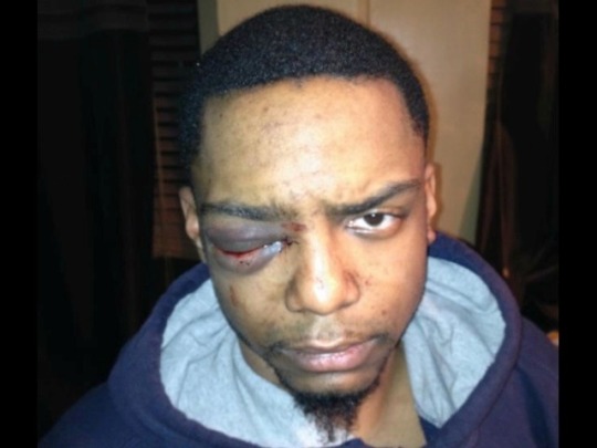 No Jail Time For Hasidic Neighborhood Patrolmen Who Brutally Beat Gay Black Student in NYC