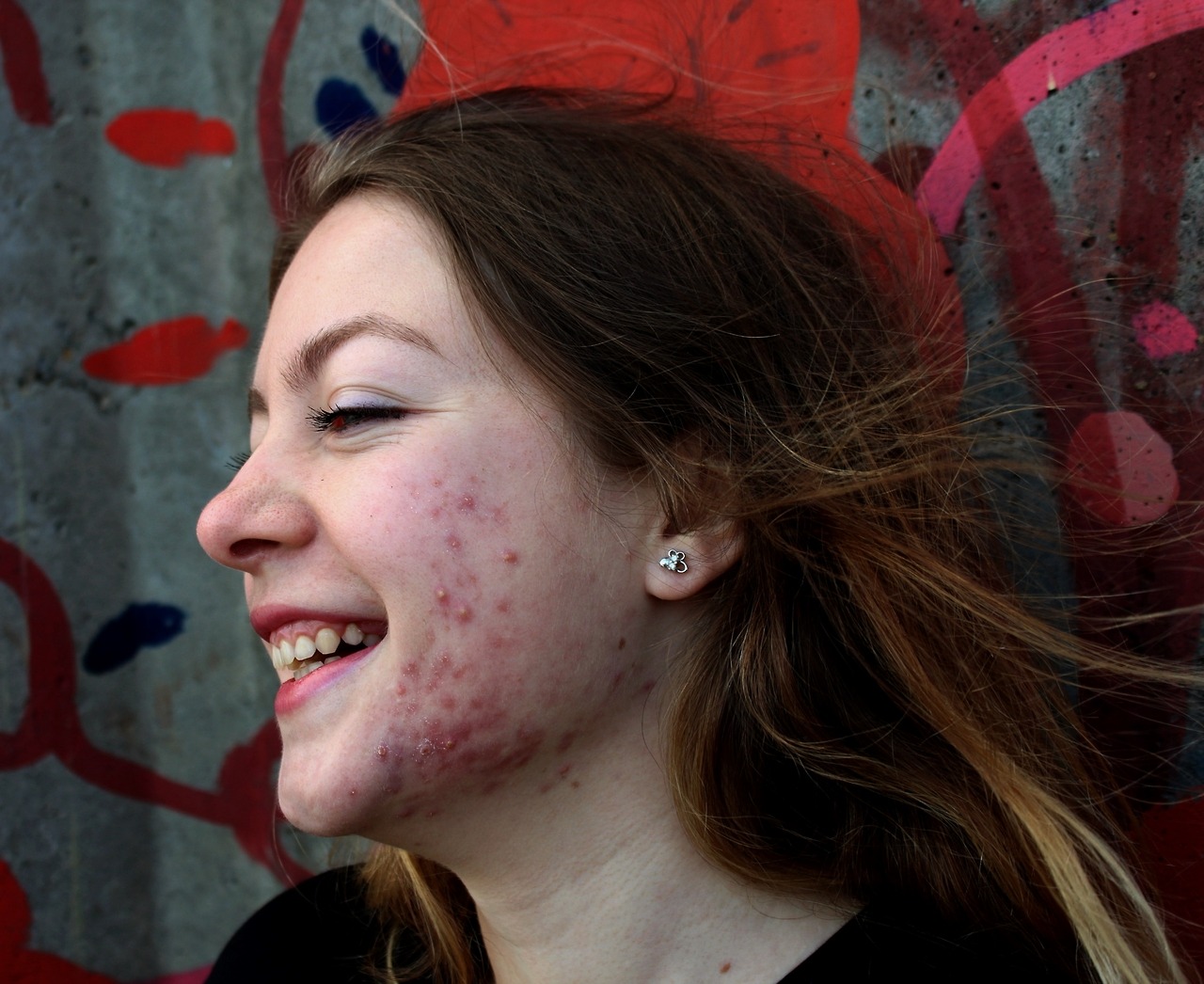 hiraeeeth:some photos of my photoproject which is called “Redefining beauty ”