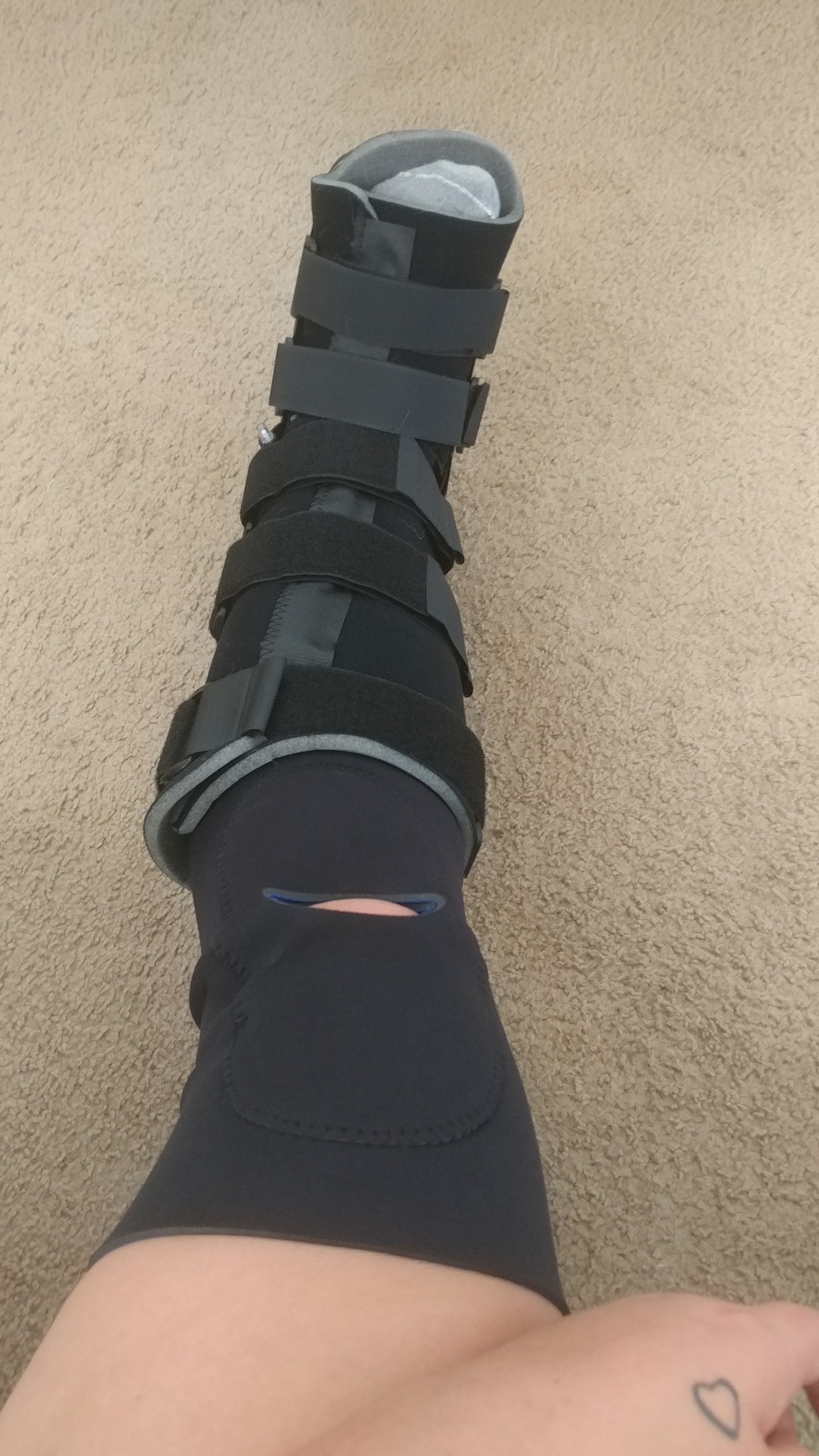 Had this put on today and got a shot in my butt. I feel a little out of it and exhausted.