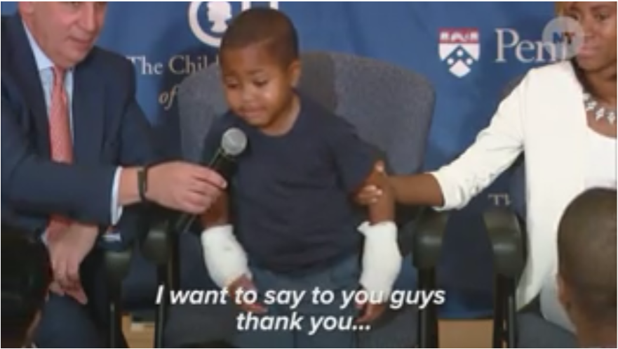 fuzzylocs:  yasboogie:  Owings Mills boy first recipient of double hand transplant