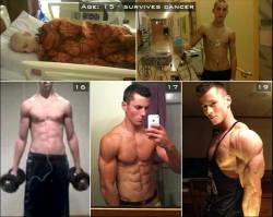 heeeeismineeee:  Cancer at age 15, Zach Zeiler’s transformation!