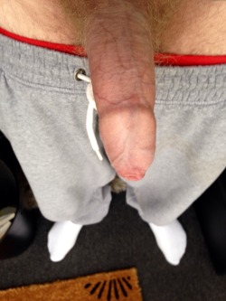 cutesoutherngay:  uncutboi7878:  tightuncut:  Can’t get my pants on…👀😈😜 #me #uncut #chub #tightforeskin #boner #trackies #chav   Hot  Only way to correct a tight foreskin is to circumcise. Though I actually do have a friend who had one and