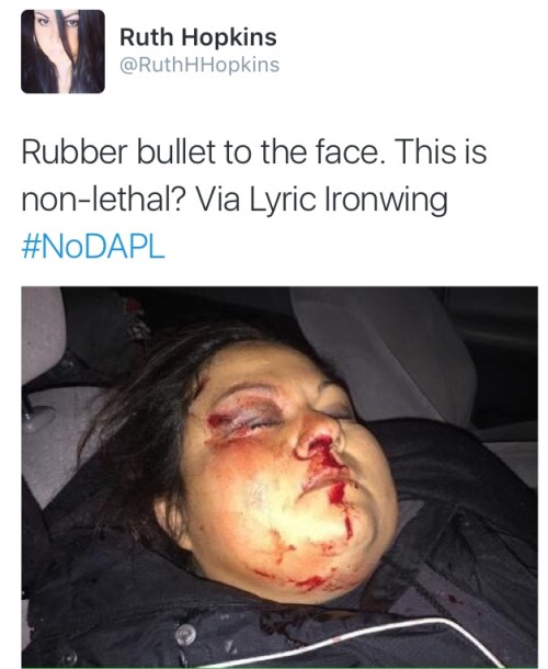 XXX ndndoll:    400 DAPL protesters ‘trapped photo