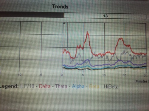 how my brainwaves changed during twenty minutes of biofeedback training