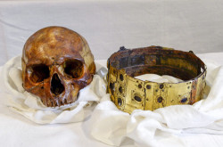 museum-of-artifacts:  Skull and crown of