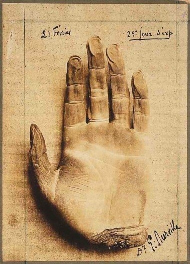 Gaston Durville, Hand of a Corpse Mummified by Mesmerism, 1913