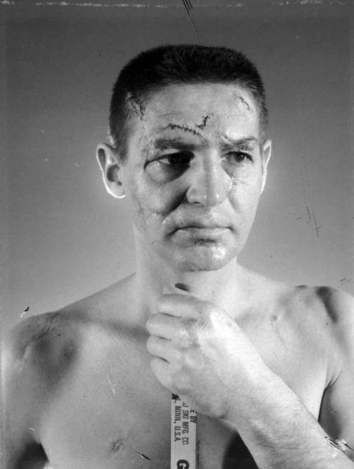 historicaltimes:The face of Detroit Red Wings’ hockey goalie, Terry Sawchuk, before masks beca
