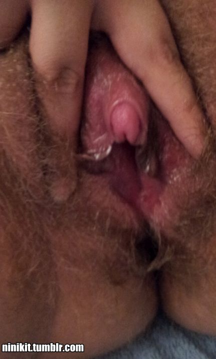 And finally, part 3 of my clit pump set.