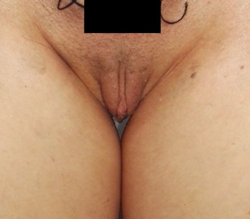 Pussy pics your post Teen Pussies