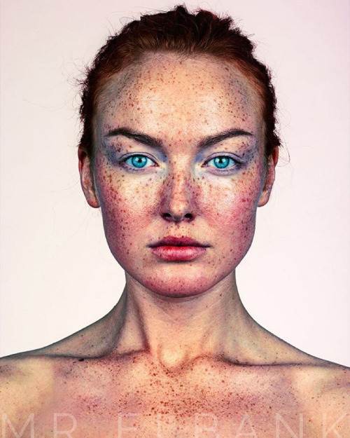 asylum-art-2:Freckled  Photographer Brock Elbank‘s ongoing project #Freckles has gathered together a