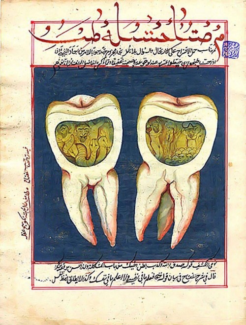 talesfromweirdland:Jinn causing toothaches. Illustration from an 18th-century Ottoman manuscript.