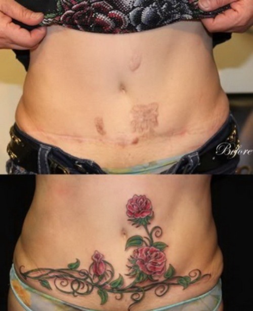 Porn Pics skindeeptales:  Amazing scar covering tattoos