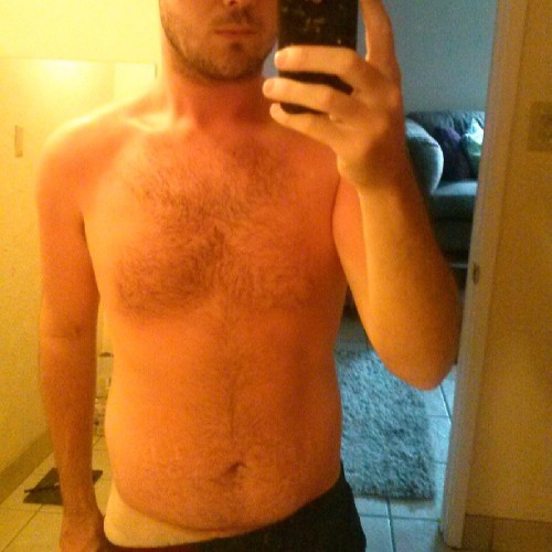 thebeardedguyy:My fucking sunburn though. Cheers to the next week of hell!