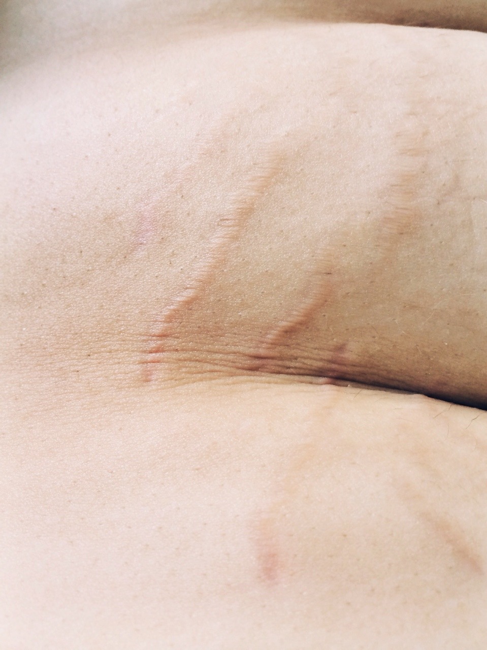 virginsplayground:  These are the parts of myself that I have been taught not to