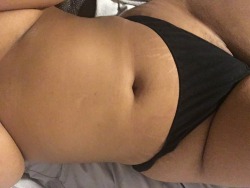 silverjets:  Learning to love my body and all of its unique manifestations of beauty.
