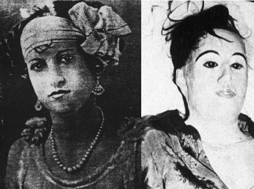 Elena Milagro de Hoyos, 21, was diagnosed with consumption in the 1920’s. Her Doctor, Carl Tanzler, fell in love with her. She died in 1931 & he stole her body from the mausoleum 2 yrs later & attempted to repair her with glass eyes & skin