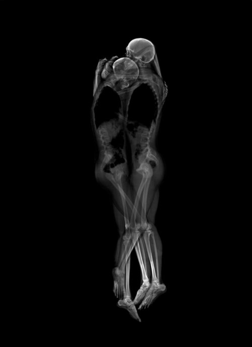 odditiesoflife: Intimate X-Ray Couple Portraits What would normally be intimate portrayals of couple