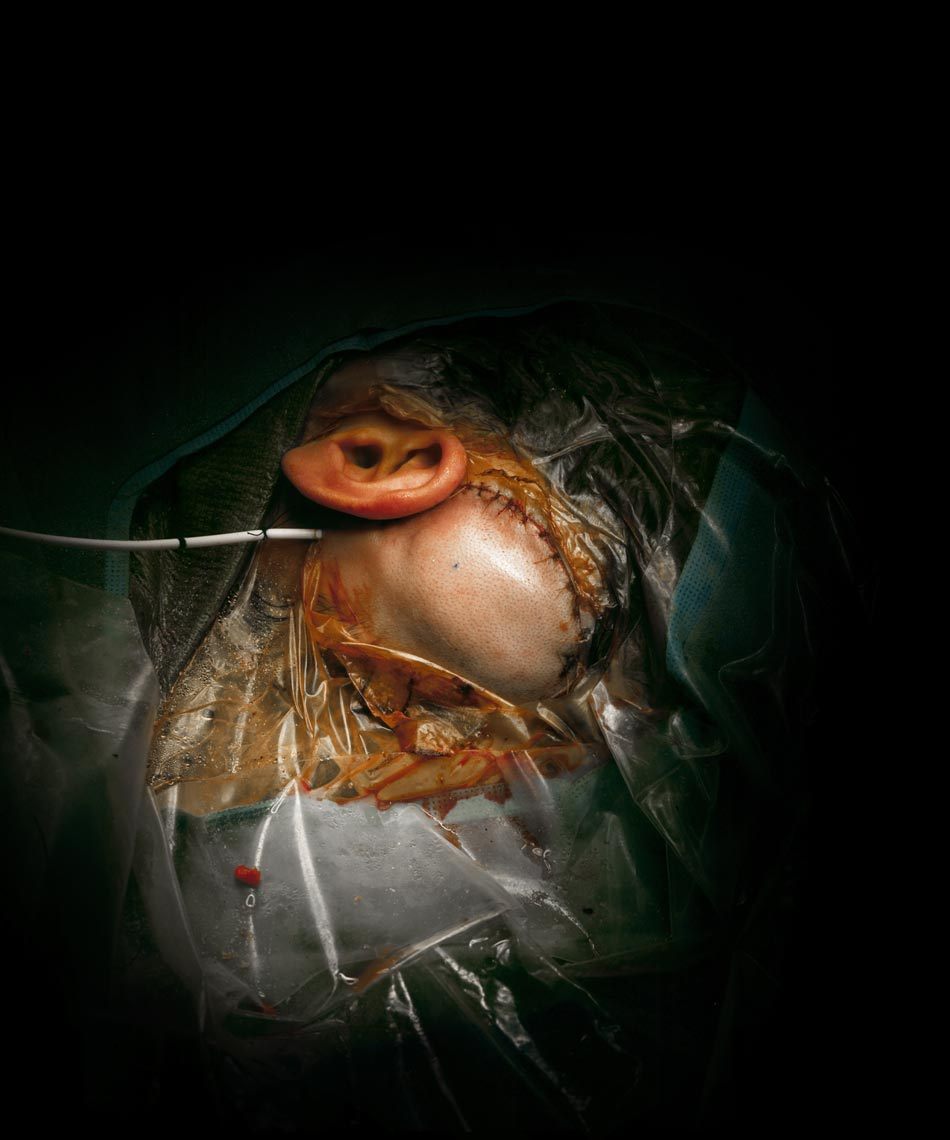 ether927:  Incredible photos from the operating room taken by Max Aguilera-Hellweg