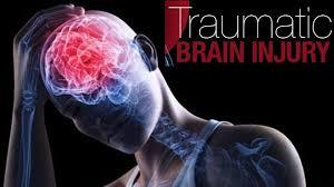 THE CORRELATION BETWEEN CRIMINAL OFFENDING AND TRAUMATIC BRAIN INJURIES IN OFFENDERS IN THE FEDERAL BUREAU OF PRISONS
By Sean R. Francis, MS
President
Justice Solutions of America, Inc.
The link between traumatic brain injuries ( TBI ) and criminal...