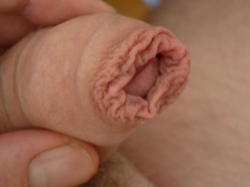 Foreskin porn pictures