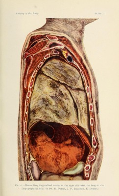 Surgery Of The Lung, C. Garre And H. Quincke, 1913.