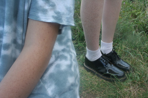 daisywasteland:white-ermine:freckles September 2013.