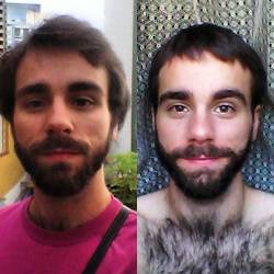 mimesmo:Antes e depois#selfie #barba #beard #mimdeixa #newhair