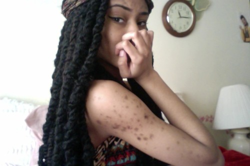 myqween:  you all made me feel so much more comfortable in my skin. now all i want to do is show it off. thank you. #blackoutig - k.breanne