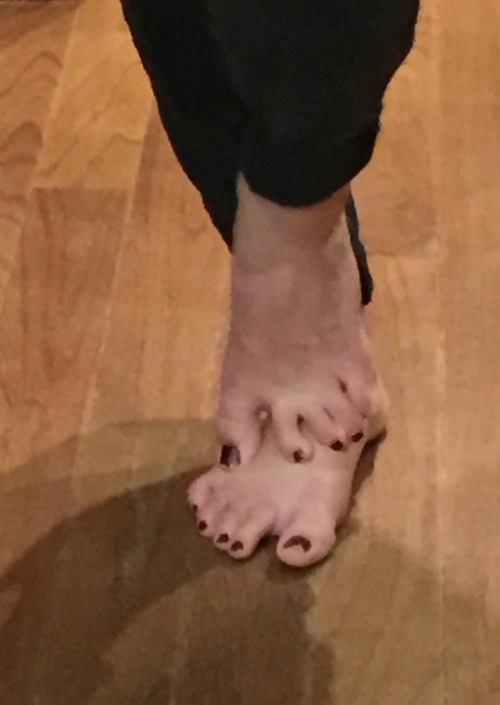 footsneaktoo: 21 yo toes. A little grainy, but you get the idea.