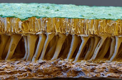 staceythinx:Some of the fascinating images from the Kuriositas gallery Under the Electron Microscope