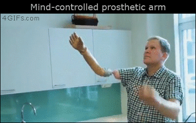 4gifs:   A Swedish amputee is the first to receive a  brain-controlled prosthetic.