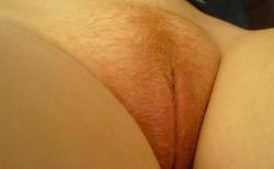 pubic hair