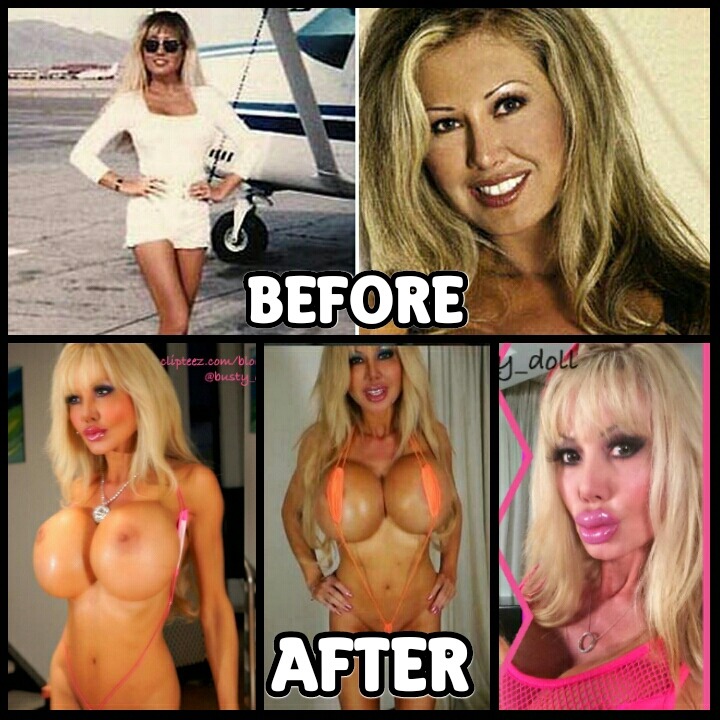 siliconetitslover:  Blondie Bennett Before / After plastic sugery ❤❤❤ MORE