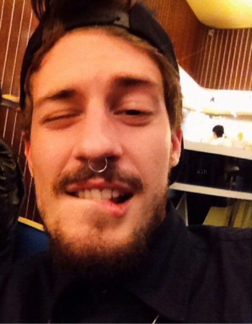 $xx$$x