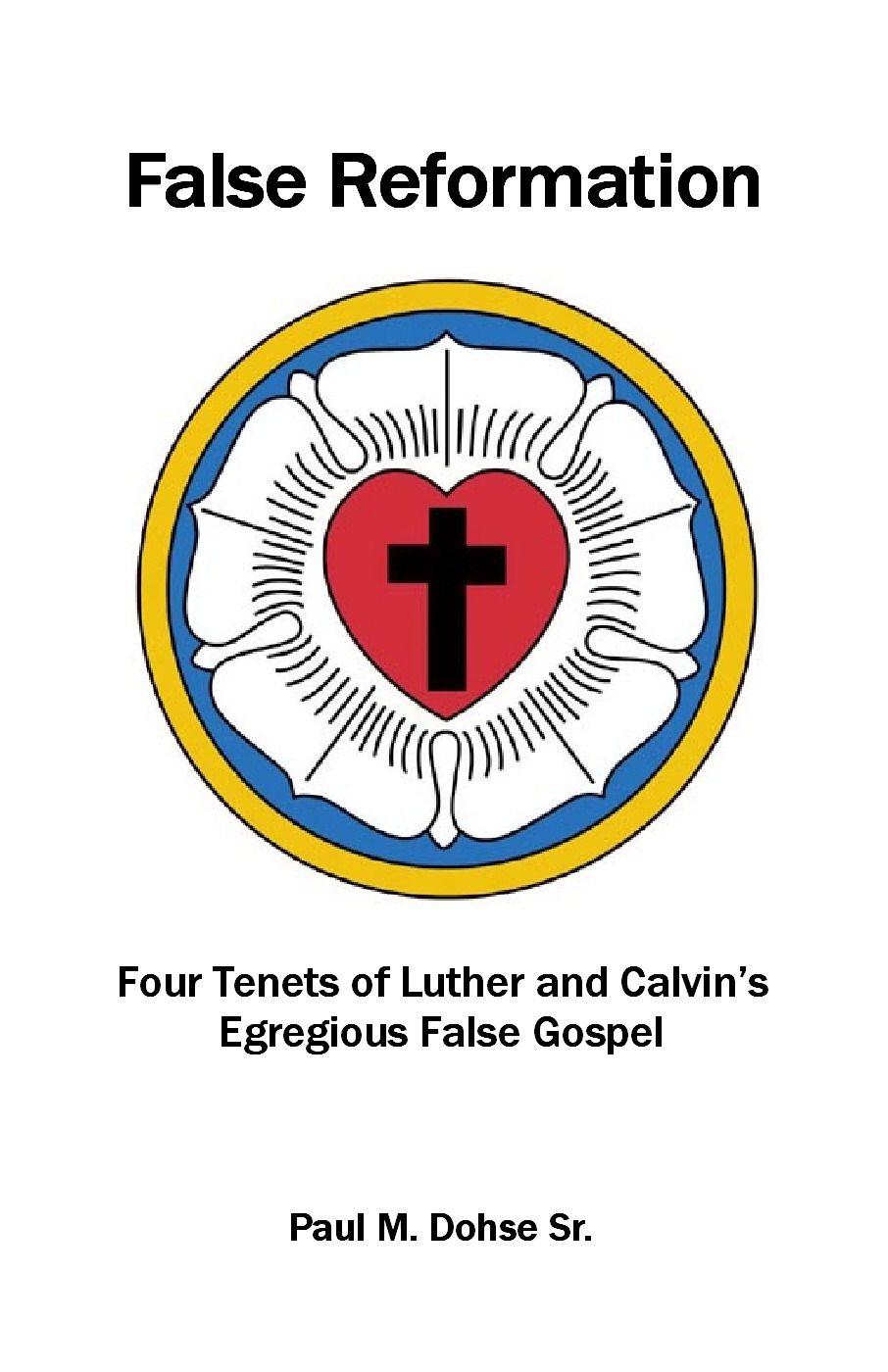 Get Over It: Calvin and Luther Propagated a Blatant False View of Justification
“Do you understand justification as a legal term in the believer is ‘declared righteous’ in the eyes of God because of the imputed righteousness of Christ that takes...