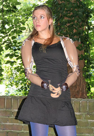 LIMBLESS GIRL