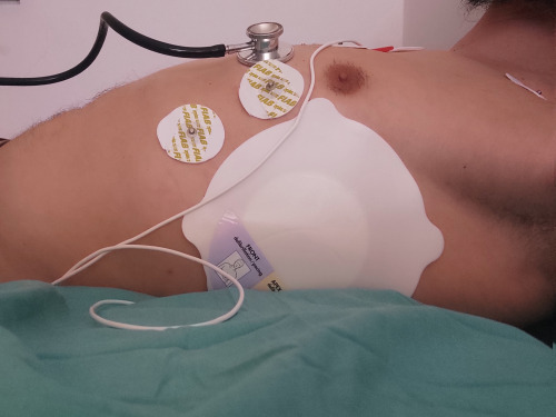 Monitoring my heart through the AED electrodes