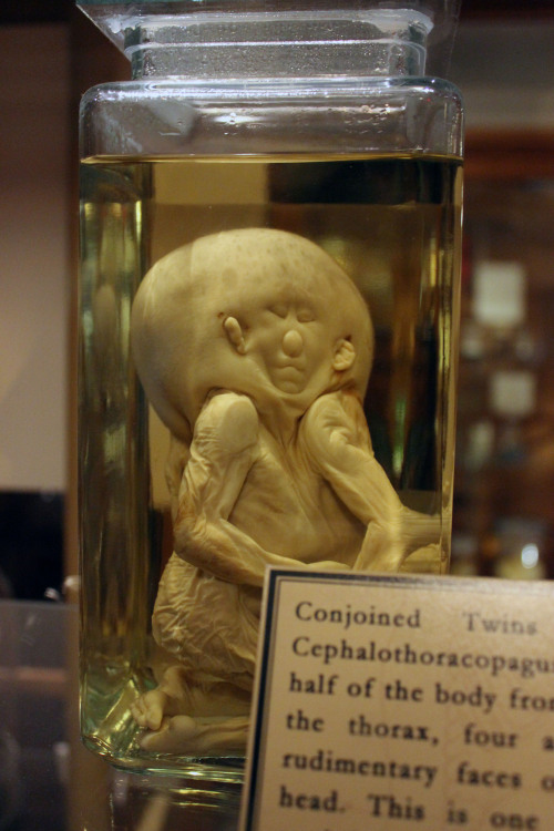 Porn Pics strangeremains:  strangebiology:  From the