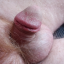 teenypeepeeclub