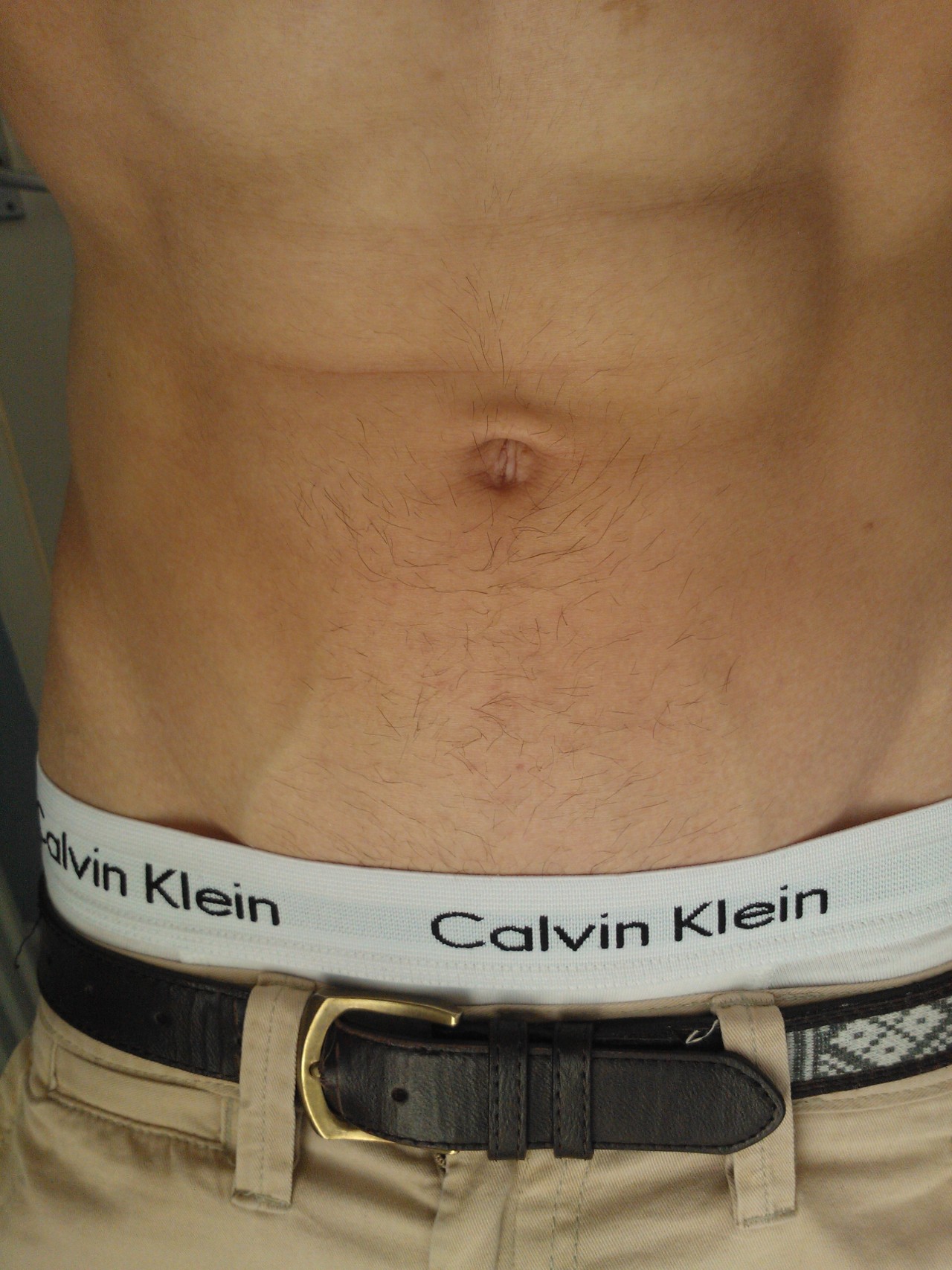 vroengard:  You can see those two random veins that I have. 