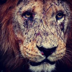 the-heart-of-the-lion:Never be ashamed of a scar. It simply means you were stronger than what tried to hurt you.