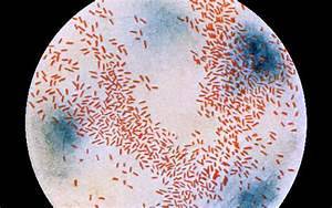Staphylococcus Haemolyticus treatment — The New Fuss About ...