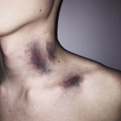 damn